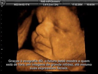 Ria slides
Graças à ecografia 4D, o futuro bebê mostra a quem
está de fora, em imagens de grande nitidez, até mesmo
suas expressões faciais.
 