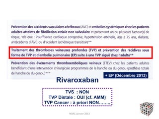 + EP (Décembre 2013)
     Rivaroxaban
         TVS : NON
  TVP Distale : OUI (cf. AMM)
TVP Cancer : à priori NON……..

          NOAC Janvier 2013
 