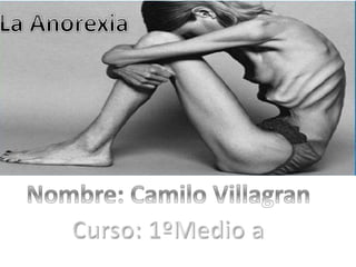 Trabajo. No Ala Anorexia Camilo Villagran