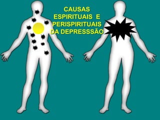 CAUSAS
ESPIRITUAIS E
PERISPIRITUAIS
DA DEPRESSSÃO
 