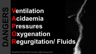 Ventilation
Acidaemia
Pressures
Oxygenation
Regurgitation/ Fluids
DANGERS
Modified from Rich Levitan (@airwaycam)
 