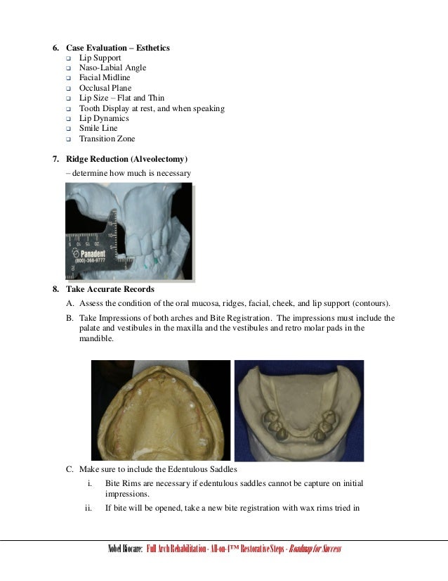 Nobel-Biocare-All-on-4-Restorative-Steps-Roadmap.pdf