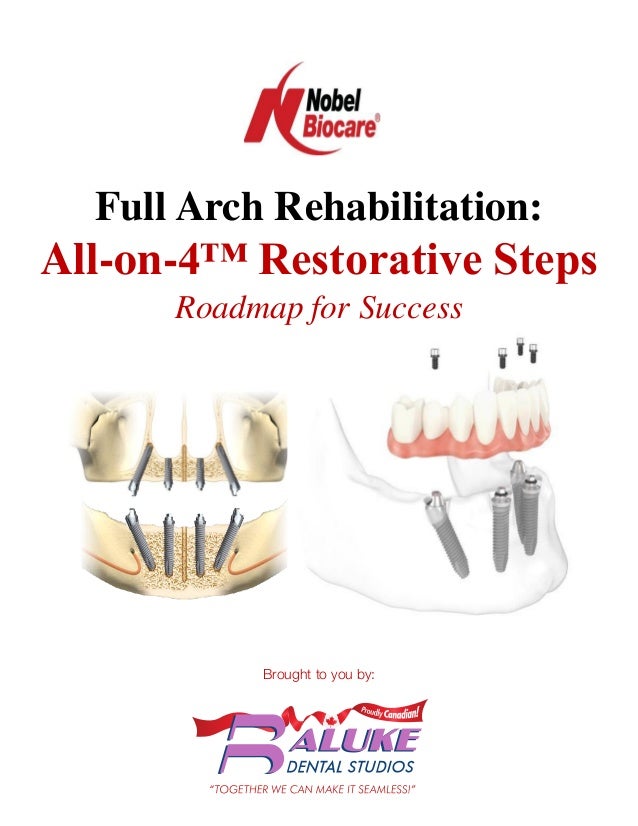 Full Arch Rehabilitation:
All-on-4™ Restorative Steps
Roadmap for Success
Brought to you by:
 