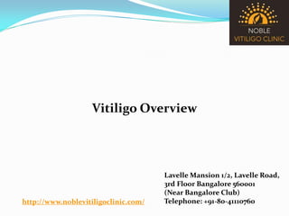 http://www.noblevitiligoclinic.com/
Lavelle Mansion 1/2, Lavelle Road,
3rd Floor Bangalore 560001
(Near Bangalore Club)
Telephone: +91-80-41110760
Vitiligo Overview
 