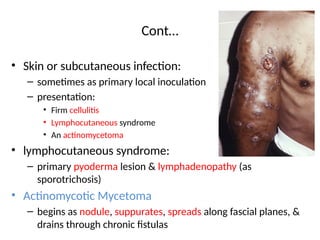 Nocardia and Actinomycoses – Clinical Features, Diagnosis, and ...
