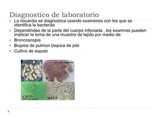 Diagnostico de laboratorio
 La nocardia se diagnostica usando examenes con los que se
identifica la bacterias
 Dependindeo de la parte del cuerpo infectada , los examnes pueden
implicar la toma de una muestra de tejido por medio de:
 Broncoscopia
 Biopsia de pulmon biopsia de piel
 Cultivo de esputo
 