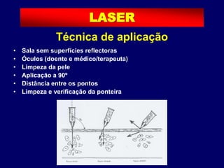 • Sala sem superfícies reflectoras
• Óculos (doente e médico/terapeuta)
• Limpeza da pele
• Aplicação a 90º
• Distância entre os pontos
• Limpeza e verificação da ponteira
LASER
Técnica de aplicação
 