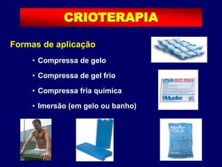 Formas de aplicação
• Compressa de gelo
• Compressa de gel frio
• Compressa fria química
• Imersão (em gelo ou banho)
CRIOTERAPIA
 