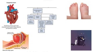 Nocturia Animation Nocturia | PPTX
