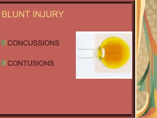 BLUNT INJURY
CONCUSSIONS
CONTUSIONS
 