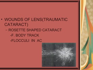 • WOUNDS OF LENS(TRAUMATIC
CATARACT)
– ROSETTE SHAPED CATARACT
-F. BODY TRACK
-FLOCCULI IN AC
 