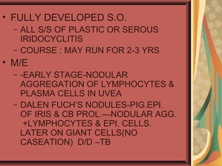 • FULLY DEVELOPED S.O.
– ALL S/S OF PLASTIC OR SEROUS
IRIDOCYCLITIS
– COURSE : MAY RUN FOR 2-3 YRS
• M/E
– -EARLY STAGE-NODULAR
AGGREGATION OF LYMPHOCYTES &
PLASMA CELLS IN UVEA
– DALEN FUCH’S NODULES-PIG.EPI.
OF IRIS & CB PROL.—NODULAR AGG.
+LYMPHOCYTES & EPI. CELLS.
LATER ON GIANT CELLS(NO
CASEATION) D/D –TB
 