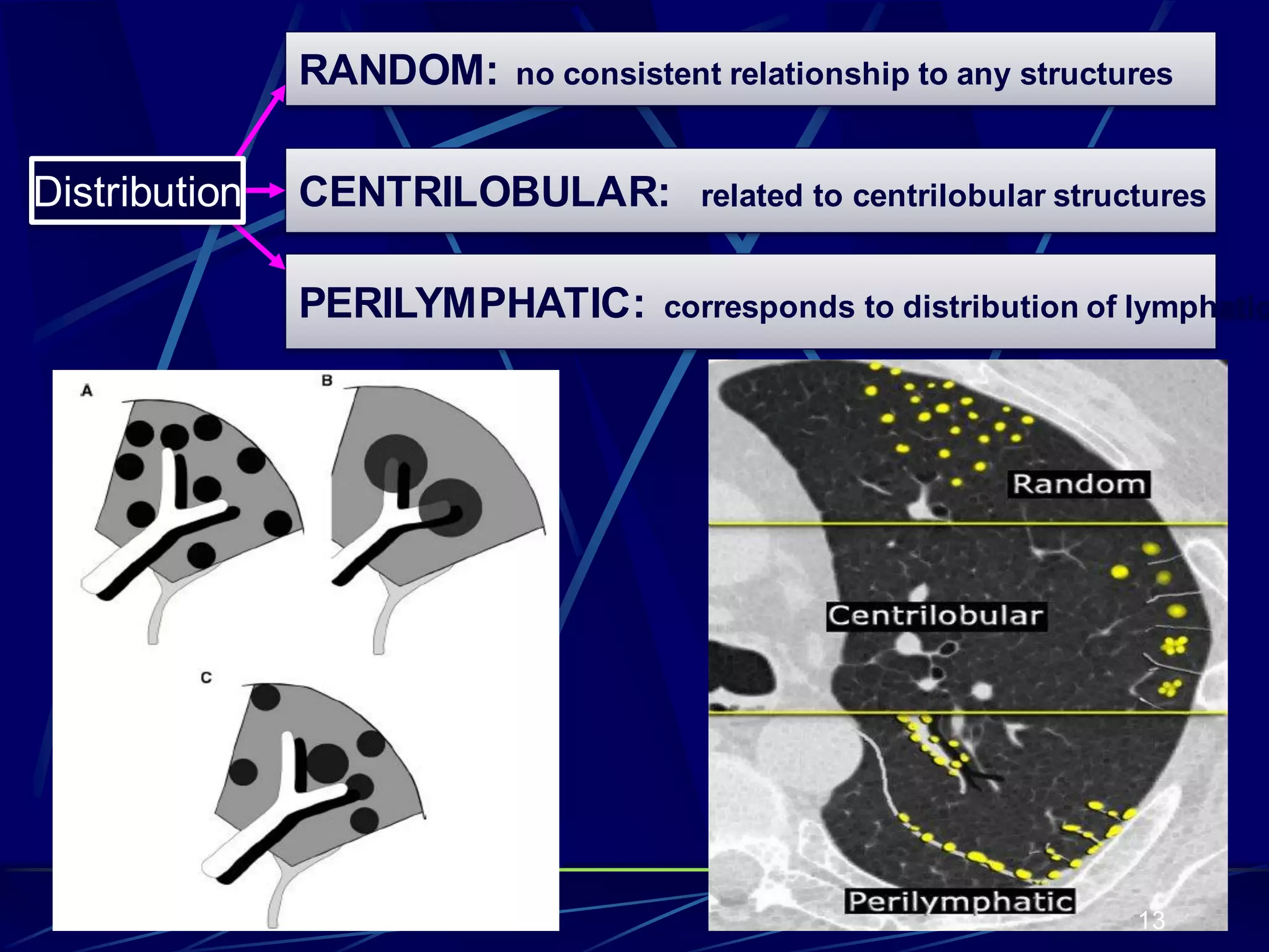 RANDOM: no consistent relationship to any structures
PERILYMPHATIC: corresponds to distribution of lymphatic
CENTRILOBULAR: related to centrilobular structuresDistribution
13
 
