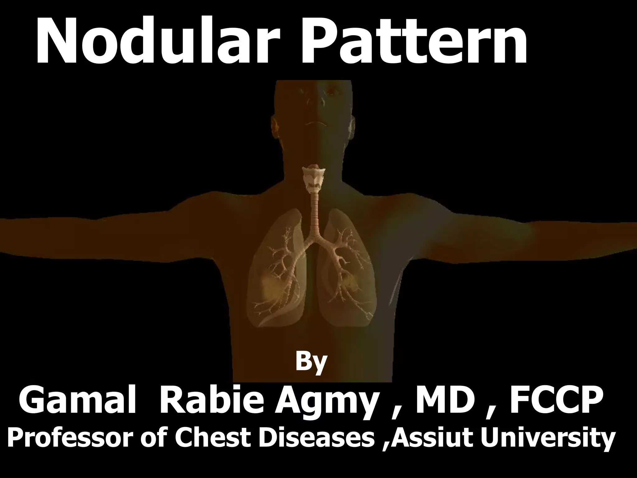 Nodular Patternitie
By
Gamal Rabie Agmy , MD , FCCP
Professor of Chest Diseases ,Assiut University
 