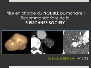 Prise en charge du NODULE pulmonaire :
Recommandations de la
FLEISCHNER SOCIETY
Dr Souhail BENNANI 4/12/18
 