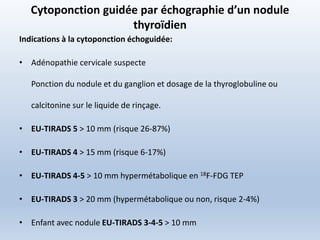 Cytoponction guidée par échographie d’un nodule
thyroïdien
Indications à la cytoponction échoguidée:
• Adénopathie cervicale suspecte
Ponction du nodule et du ganglion et dosage de la thyroglobuline ou
calcitonine sur le liquide de rinçage.
• EU-TIRADS 5 > 10 mm (risque 26-87%)
• EU-TIRADS 4 > 15 mm (risque 6-17%)
• EU-TIRADS 4-5 > 10 mm hypermétabolique en 18F-FDG TEP
• EU-TIRADS 3 > 20 mm (hypermétabolique ou non, risque 2-4%)
• Enfant avec nodule EU-TIRADS 3-4-5 > 10 mm
 