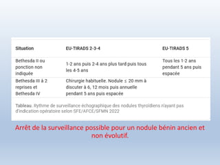 Arrêt de la surveillance possible pour un nodule bénin ancien et
non évolutif.
 