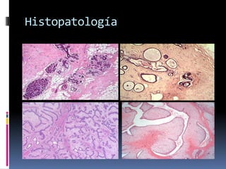 Histopatología
 