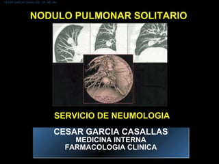 NODULO PULMONAR SOLITARIO CESAR GARCIA CASALLAS MEDICINA INTERNA FARMACOLOGIA CLINICA SERVICIO DE NEUMOLOGIA CESAR GARCIA CASALLAS.  QF  MD Msc 