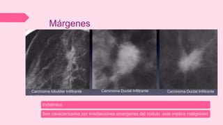 Márgenes
Indistintos
Son caracterizados por irradiaiciones emergenes del nódulo, este implica malignidad
 