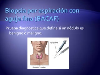 Nodulo tiroideo | PPT