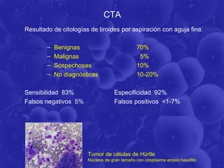 CTA
Resultado de citologías de tiroides por aspiración con aguja fina:

        –   Benignas                          70%
        –   Malignas                           5%
        –   Sospechosas                       10%
        –   No diagnósticas                   10-20%

Sensibilidad 83%                   Especificidad 92%
Falsos negativos 5%                Falsos positivos <1-7%




                       Tumor de células de Hürtle
                       Núcleos de gran tamaño con citoplasma amplio basófilo
 