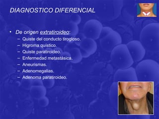 DIAGNOSTICO DIFERENCIAL


• De origen extratiroideo:
   –   Quiste del conducto tirogloso.
   –   Higroma quístico.
   –   Quiste paratiroideo.
   –   Enfermedad metastásica.
   –   Aneurismas.
   –   Adenomegalias.
   –   Adenoma paratiroideo.
 