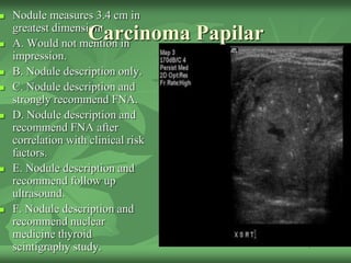 Nodule measures 3.4 cm in
greatest dimension.
 A. Would not mention in
impression.
 B. Nodule description only.
 C. Nodule description and
strongly recommend FNA.
 D. Nodule description and
recommend FNA after
correlation with clinical risk
factors.
 E. Nodule description and
recommend follow up
ultrasound.
 F. Nodule description and
recommend nuclear
medicine thyroid
scintigraphy study.
Carcinoma Papilar
 