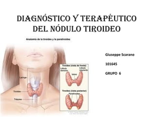 Diagnóstico y terapéutico
Del nóDulo tiroiDeo
Giuseppe Scarano
101645
GRUPO 6
 