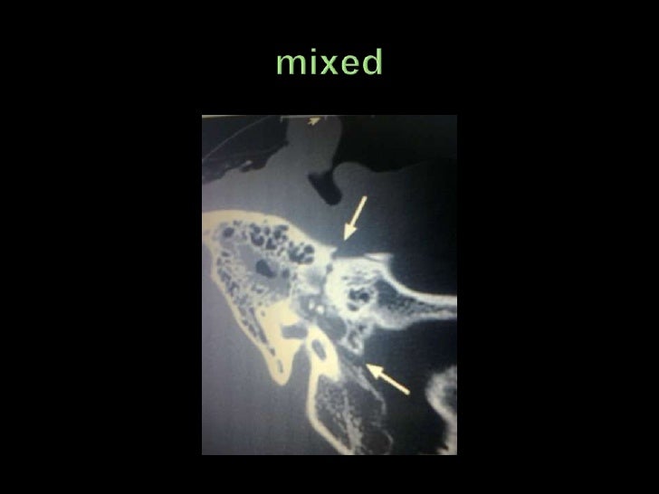 NEURO-OTOLOGICAL EMERGENCIES