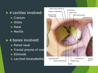  4 cavities involved:
 Cranium
 Orbits
 Nasal
 Maxilla
 4 bones involved:
 Paired nasal
 Frontal process of maxilla
 Ethmoids
 Lacrimal bones(Medial orbital rim and wall)
 