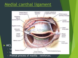 Medial canthal ligament
 MCL Intimately related to :
• Lacrimal drainage apparatus
• Lacrimal bone
• Frontal process of maxilla – reinforces.
 