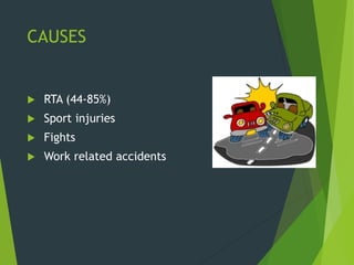 CAUSES
 RTA (44-85%)
 Sport injuries
 Fights
 Work related accidents
 