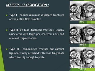 AYLIFF’S CLASSIFICATION :
 Type I – en bloc minimum displaced fractures
of the entire NOE complex
 Type II– en bloc displaced fractures, usually
associated with large pneumatized sinus and
minimal fragmentation
 Type III – comminuted fracture but canthal
ligament firmly attached with bone fragments
which are big enough to plate.
TYPE I
TYPE II
TYPE III
 