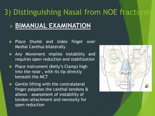 3) Distinguishing Nasal from NOE fractures
 BIMANUAL EXAMINATION
 Place thumb and index finger over
Medial Canthus bilaterally
 Any Movement implies instability and
requires open reduction and stabilization
 Place instrument (Kelly’s Clamp) high
into the nose , with its tip directly
beneath the MCT
 Gentle lifting with the contralateral
finger palpates the canthal tendons &
allows – assessment of instability of
tendon attachment and necessity for
open reduction
 