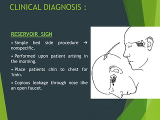 RESERVOIR SIGN
• Simple bed side procedure 
nonspecific.
• Performed upon patient arising in
the morning.
• Place patients chin to chest for
1min.
• Copious leakage through nose like
an open faucet.
CLINICAL DIAGNOSIS :
 