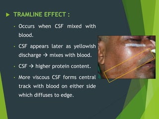  TRAMLINE EFFECT :
• Occurs when CSF mixed with
blood.
• CSF appears later as yellowish
discharge  mixes with blood.
• CSF  higher protein content.
• More viscous CSF forms central
track with blood on either side
which diffuses to edge.
 