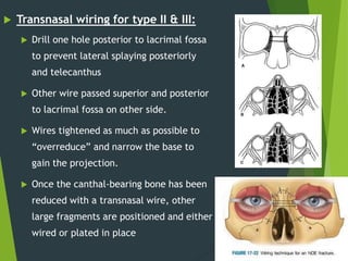  Transnasal wiring for type II & III:
 Drill one hole posterior to lacrimal fossa
to prevent lateral splaying posteriorly
and telecanthus
 Other wire passed superior and posterior
to lacrimal fossa on other side.
 Wires tightened as much as possible to
“overreduce” and narrow the base to
gain the projection.
 Once the canthal-bearing bone has been
reduced with a transnasal wire, other
large fragments are positioned and either
wired or plated in place
 