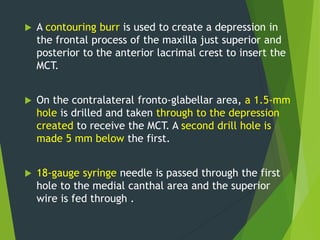  A contouring burr is used to create a depression in
the frontal process of the maxilla just superior and
posterior to the anterior lacrimal crest to insert the
MCT.
 On the contralateral fronto-glabellar area, a 1.5-mm
hole is drilled and taken through to the depression
created to receive the MCT. A second drill hole is
made 5 mm below the first.
 18-gauge syringe needle is passed through the first
hole to the medial canthal area and the superior
wire is fed through .
 