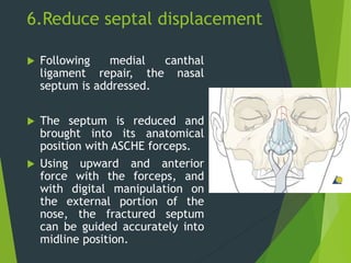 6.Reduce septal displacement
 Following medial canthal
ligament repair, the nasal
septum is addressed.
 The septum is reduced and
brought into its anatomical
position with ASCHE forceps.
 Using upward and anterior
force with the forceps, and
with digital manipulation on
the external portion of the
nose, the fractured septum
can be guided accurately into
midline position.
 