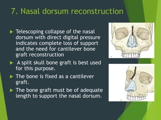 7. Nasal dorsum reconstruction
 Telescoping collapse of the nasal
dorsum with direct digital pressure
indicates complete loss of support
and the need for cantilever bone
graft reconstruction
 A split skull bone graft is best used
for this purpose.
 The bone is fixed as a cantilever
graft.
 The bone graft must be of adequate
length to support the nasal dorsum.
 