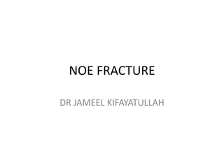 NOE FRACTURE
DR JAMEEL KIFAYATULLAH
 