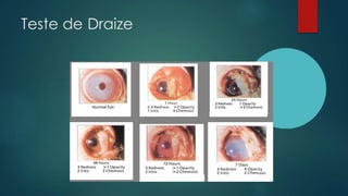 Teste de Draize
 