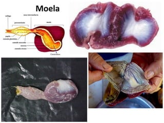 Moela
 