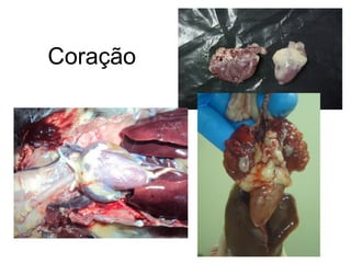 Coração
 