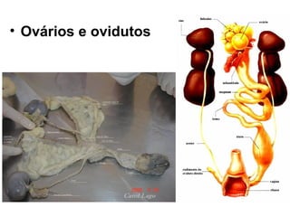 • Ovários e ovidutos
 