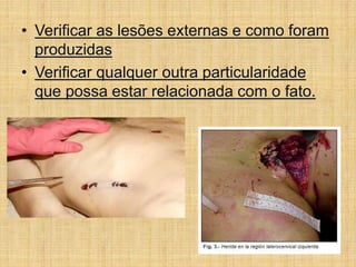 • Verificar as lesões externas e como foram
produzidas
• Verificar qualquer outra particularidade
que possa estar relacionada com o fato.
 