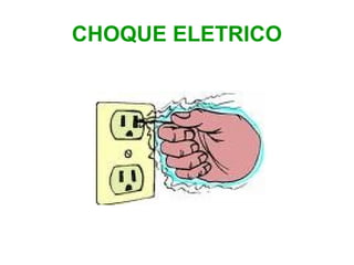 CHOQUE ELETRICO

 