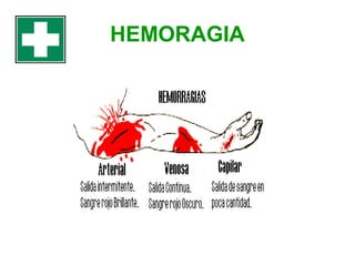 HEMORAGIA

 