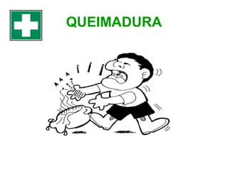 QUEIMADURA

 